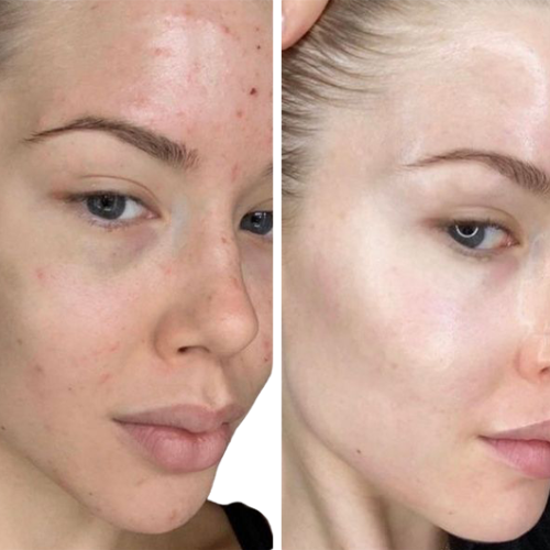 Masque - Peaux parfaites en 7 jours