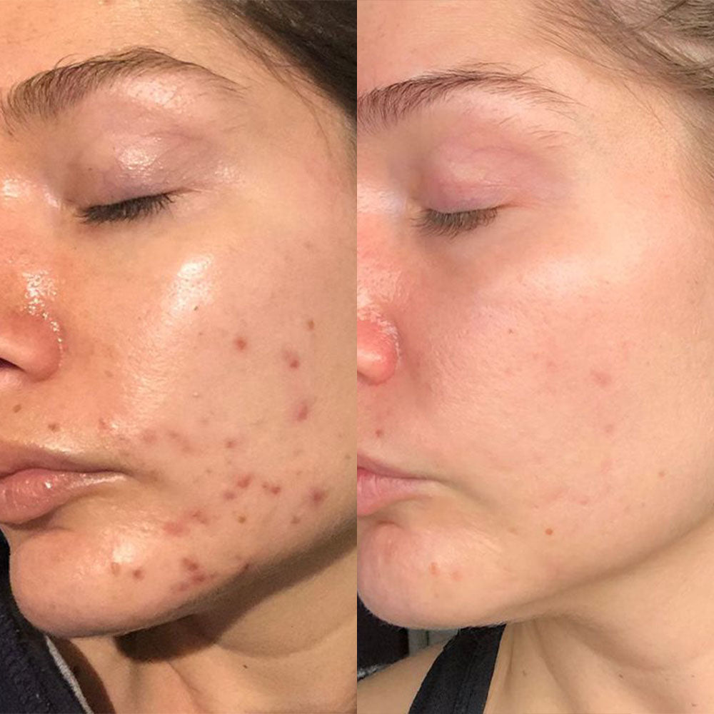 Masque - Peaux parfaites en 7 jours